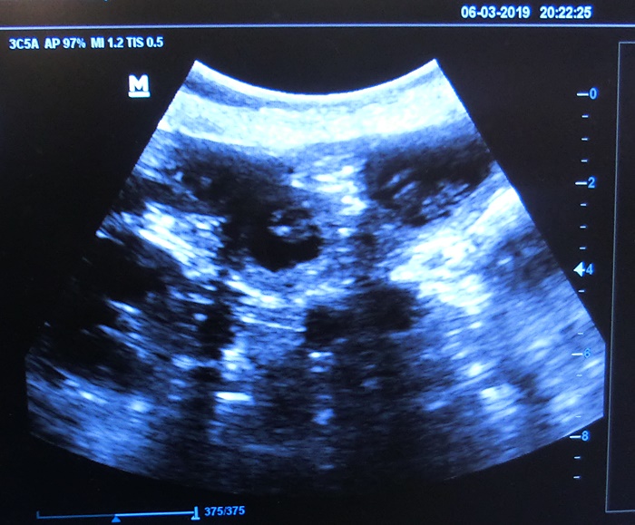 Ultraschallbild Margeta's Oriella Ulraschallbild zu Oriella